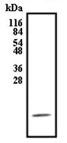 Western blot - Anti-AIMP3/p18 antibody (AB31543)