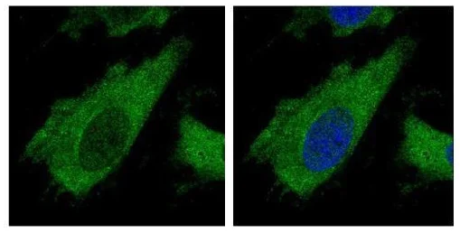 Immunocytochemistry/ Immunofluorescence - Anti-AIP antibody (AB228684)