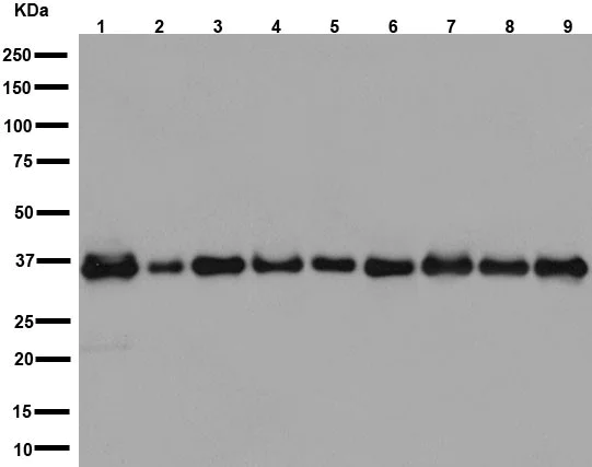 Western blot - Anti-AIP antibody [EPR13585] (AB192024)