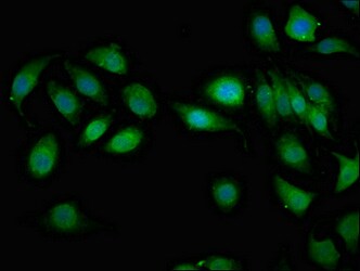 Immunocytochemistry/ Immunofluorescence - Anti-AIP1 antibody (AB238688)