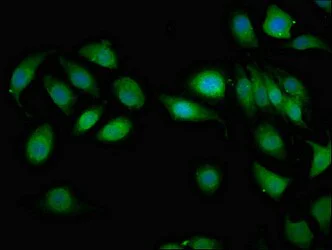 Immunocytochemistry/ Immunofluorescence - Anti-AIP1 antibody (AB238688)