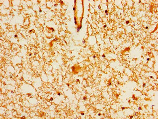 Immunohistochemistry (Formalin/PFA-fixed paraffin-embedded sections) - Anti-AIP1 antibody (AB238688)
