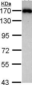 Western blot - Anti-AIP1 antibody (AB97343)