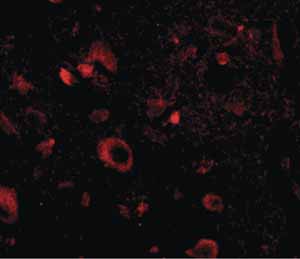 Immunocytochemistry/ Immunofluorescence - Anti-AIPL1 antibody (AB79039), expandable thumbnail