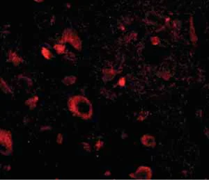 Immunocytochemistry/ Immunofluorescence - Anti-AIPL1 antibody (AB79039)