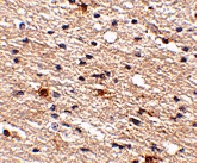 Immunohistochemistry (Formalin/PFA-fixed paraffin-embedded sections) - Anti-AIPL1 antibody (AB79039), expandable thumbnail