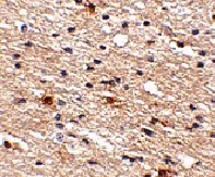 Immunohistochemistry (Formalin/PFA-fixed paraffin-embedded sections) - Anti-AIPL1 antibody (AB79039)
