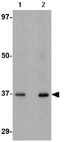 Western blot - Anti-AIPL1 antibody (AB79039)