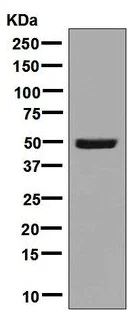 Western blot - Anti-AIPL1 antibody [EPR7711] (AB128960)