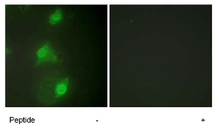 Immunocytochemistry/ Immunofluorescence - Anti-AIRE antibody (AB65040)