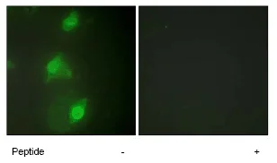 Immunocytochemistry/ Immunofluorescence - Anti-AIRE antibody (AB65040)