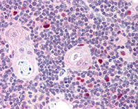Immunohistochemistry (Formalin/PFA-fixed paraffin-embedded sections) - Anti-AIRE antibody (AB78065)