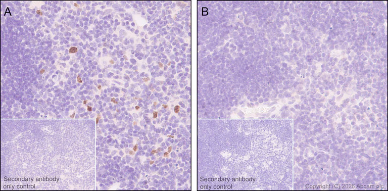 Immunohistochemistry (Formalin/PFA-fixed paraffin-embedded sections) - Anti-AIRE antibody [EPR24411-22] (AB270972)