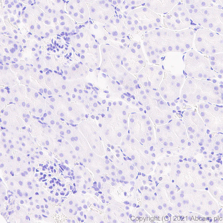 Immunohistochemistry (Formalin/PFA-fixed paraffin-embedded sections) - Anti-AIRE antibody [EPR24411-22] - BSA and Azide free (AB283663)