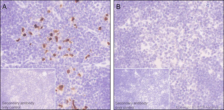 Immunohistochemistry (Formalin/PFA-fixed paraffin-embedded sections) - Anti-AIRE antibody [EPR28045-139] (AB315164)