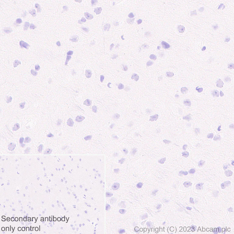 Immunohistochemistry (Formalin/PFA-fixed paraffin-embedded sections) - Anti-AIRE antibody [EPR28045-139] - BSA and Azide free (AB315165)