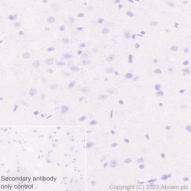Immunohistochemistry (Formalin/PFA-fixed paraffin-embedded sections) - Anti-AIRE antibody [EPR28045-139] - BSA and Azide free (AB315165)