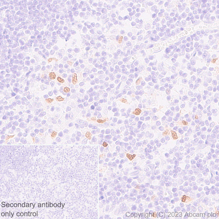 Immunohistochemistry (Formalin/PFA-fixed paraffin-embedded sections) - Anti-AIRE antibody [EPR28045-139] - BSA and Azide free (AB315165)