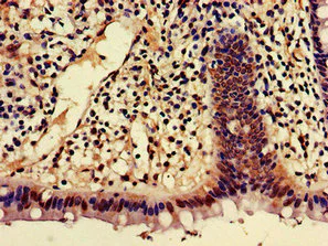 Immunohistochemistry (Formalin/PFA-fixed paraffin-embedded sections) - Anti-AJAP1 antibody (AB223117)