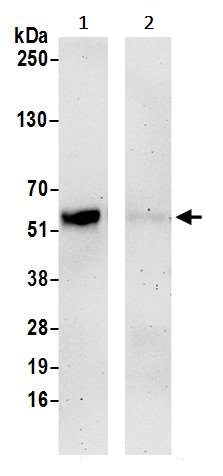 Immunoprecipitation - Anti-Ajuba antibody (AB241957)