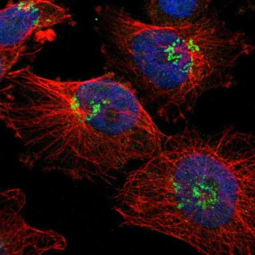 Immunocytochemistry/ Immunofluorescence - Anti-Ajuba antibody (AB244285)