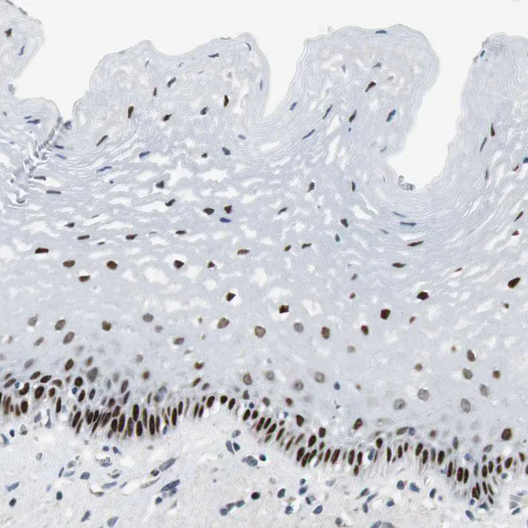 Immunohistochemistry (Formalin/PFA-fixed paraffin-embedded sections) - Anti-Ajuba antibody (AB244285)