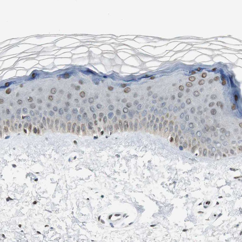 Immunohistochemistry (Formalin/PFA-fixed paraffin-embedded sections) - Anti-Ajuba antibody (AB244285)