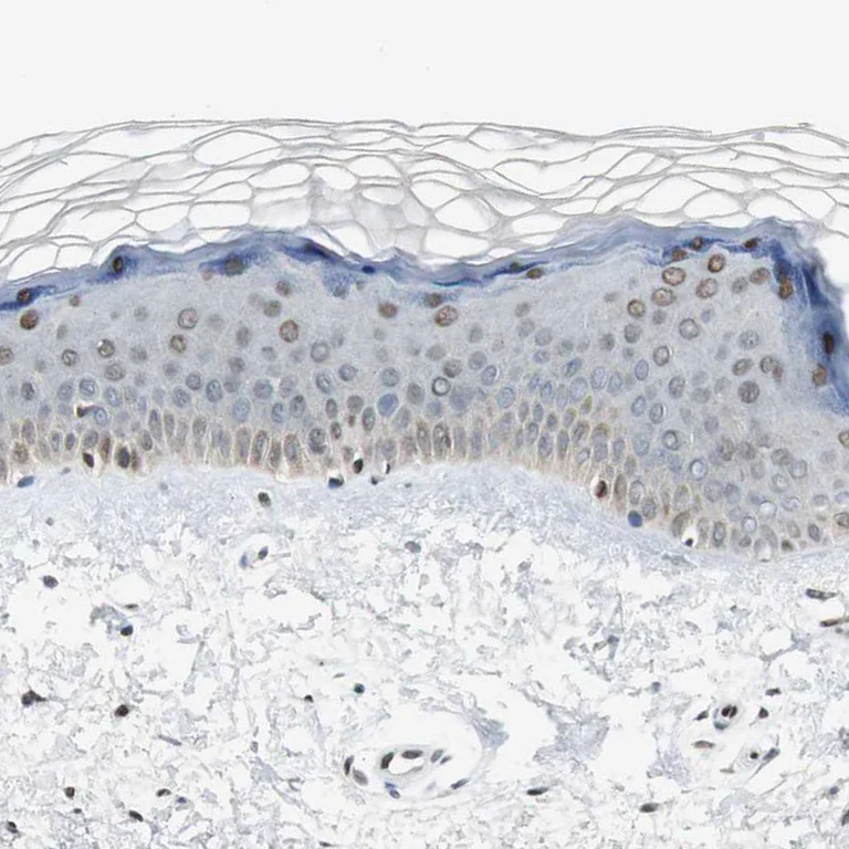 Immunohistochemistry (Formalin/PFA-fixed paraffin-embedded sections) - Anti-Ajuba antibody (AB244285)