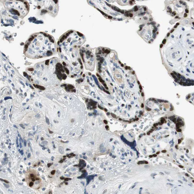 Immunohistochemistry (Formalin/PFA-fixed paraffin-embedded sections) - Anti-Ajuba antibody (AB244285)