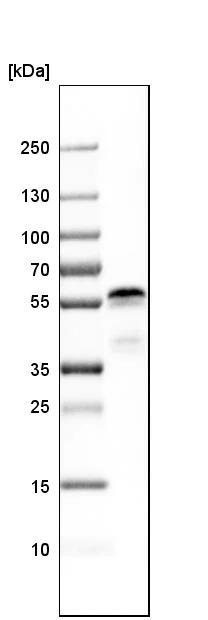 Western blot - Anti-Ajuba antibody (AB244285)