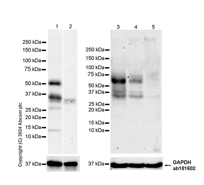 Western blot - Anti-Ajuba antibody [EPR27503-126] (AB316197)