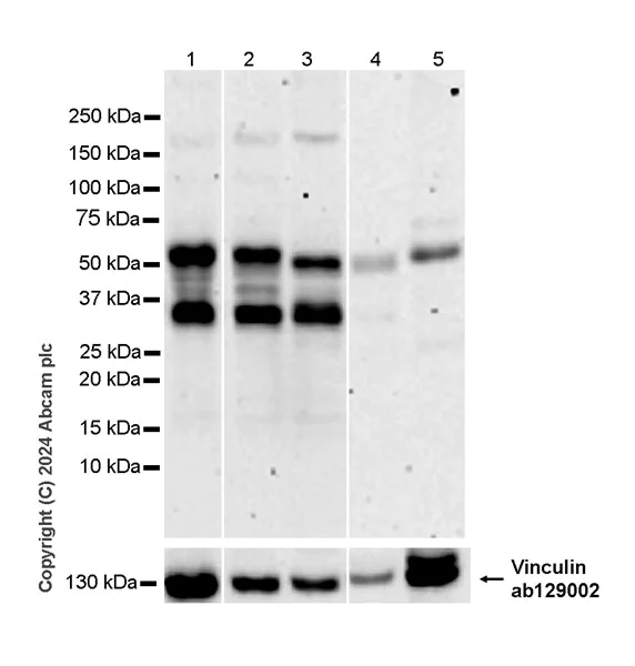 Western blot - Anti-Ajuba antibody [EPR27503-126] - BSA and Azide free (AB316198)