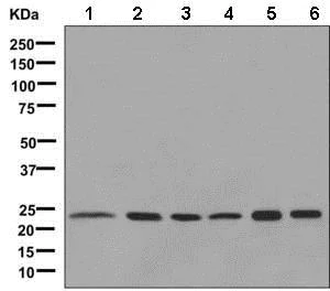 Western blot - Anti-AK 1 antibody [EP7083] - BSA and Azide free (AB284814)
