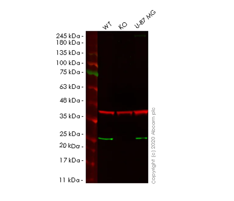 Western blot - Anti-AK 1 antibody [EP7083] - BSA and Azide free (AB284814)