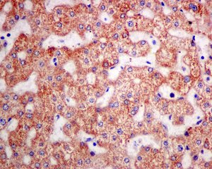 Immunohistochemistry (Formalin/PFA-fixed paraffin-embedded sections) - Anti-AK2 antibody [EPR11387(B)] (AB157206), expandable thumbnail