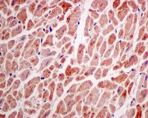 Immunohistochemistry (Formalin/PFA-fixed paraffin-embedded sections) - Anti-AK2 antibody [EPR11387(B)] (AB157206), expandable thumbnail