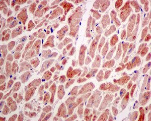 Immunohistochemistry (Formalin/PFA-fixed paraffin-embedded sections) - Anti-AK2 antibody [EPR11387(B)] (AB157206)