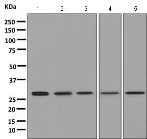 Western blot - Anti-AK2 antibody [EPR11387(B)] (AB157206), expandable thumbnail