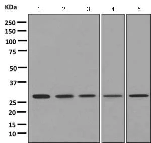 Western blot - Anti-AK2 antibody [EPR11387(B)] (AB157206)