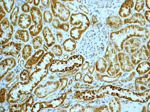 Immunohistochemistry (Formalin/PFA-fixed paraffin-embedded sections) - Anti-AK2 antibody [EPR11388(B)] (AB166901), expandable thumbnail