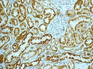 Immunohistochemistry (Formalin/PFA-fixed paraffin-embedded sections) - Anti-AK2 antibody [EPR11388(B)] (AB166901)