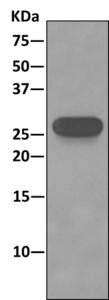 Immunoprecipitation - Anti-AK2 antibody [EPR11388(B)] - BSA and Azide free (AB249383), expandable thumbnail