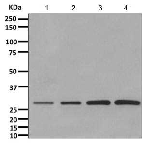 Western blot - Anti-AK2 antibody [EPR11388(B)] - BSA and Azide free (AB249383), expandable thumbnail