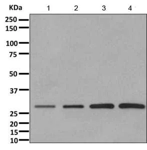 Western blot - Anti-AK2 antibody [EPR11388(B)] - BSA and Azide free (AB249383)