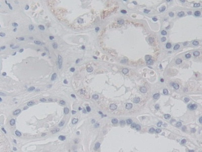 Immunohistochemistry (Formalin/PFA-fixed paraffin-embedded sections) - Anti-AK3 antibody (AB232888)