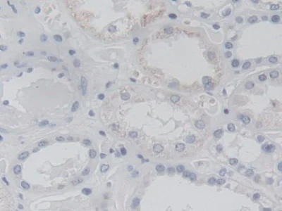 Immunohistochemistry (Formalin/PFA-fixed paraffin-embedded sections) - Anti-AK3 antibody (AB232888)