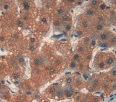 Immunohistochemistry (Formalin/PFA-fixed paraffin-embedded sections) - Anti-AK3 antibody (AB232888)