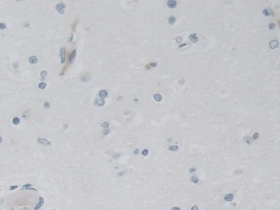 Immunohistochemistry (Formalin/PFA-fixed paraffin-embedded sections) - Anti-AK3 antibody (AB232888)