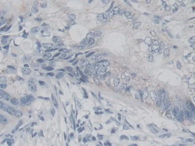 Immunohistochemistry (Formalin/PFA-fixed paraffin-embedded sections) - Anti-AK3 antibody (AB232888)