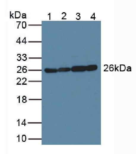 Western blot - Anti-AK3 antibody (AB232888)